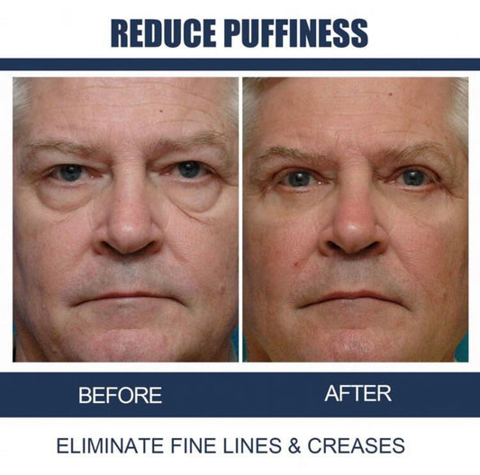 Eye cream